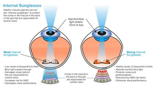 amd eye, eye diseases, dry amd, macular degeneration