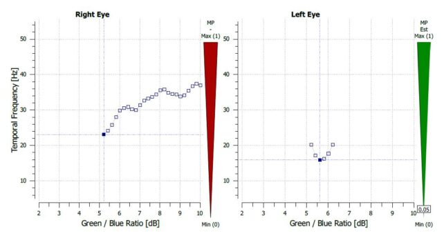 macular degeneration, dry amd, macular degeneration screening